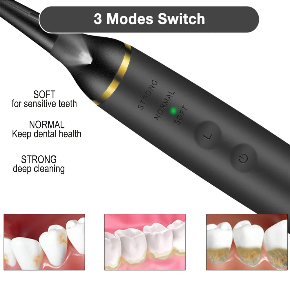 Vibe Geeks USB Rechargeable Electric Dental Calculus Tooth